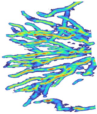 3D photoacoustic reconstruction of blood vessels